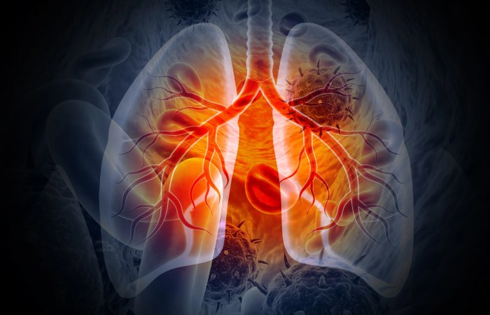 Who is at increased risk of PM2.5 exposure_